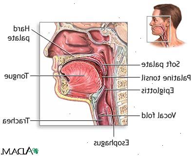 Epiglottit. Vad är struplocket?